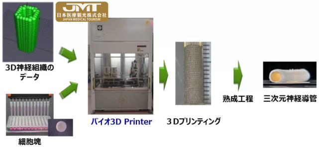 日本京都大学医院用生物3D打印机再生受损手指末梢神经的临床试验