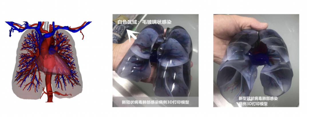 看见星云力量 NO.16丨普锐霆医疗：助力临床外科数字化精准诊疗的3D技术