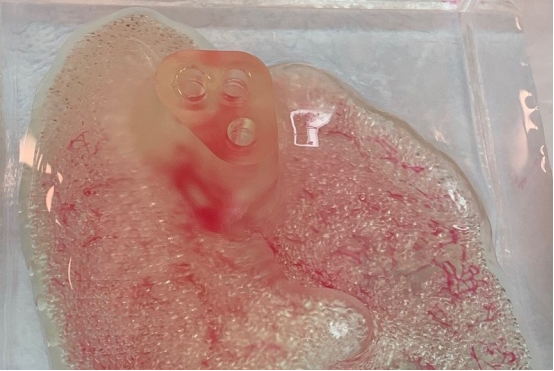 哈佛大学科学家开发3D打印人体肾脏组织，减轻终末期肾病患者痛苦