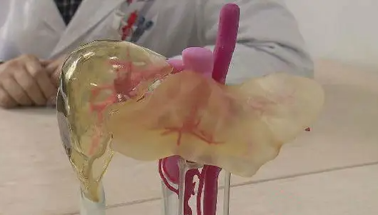 3D打印技术的四种方式，将改变医疗行业