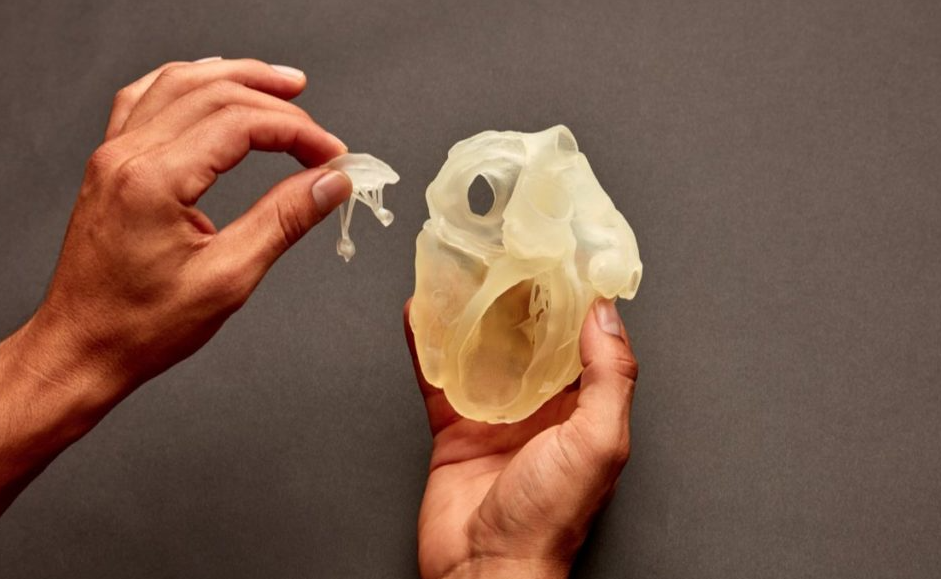 某团队自主研发的3D打印患者匹配式人工椎体获批上市