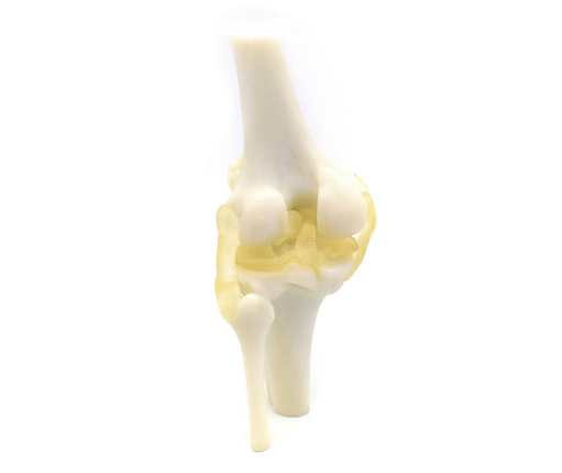骨科3D打印技术已经成为骨科诊疗黑科技 