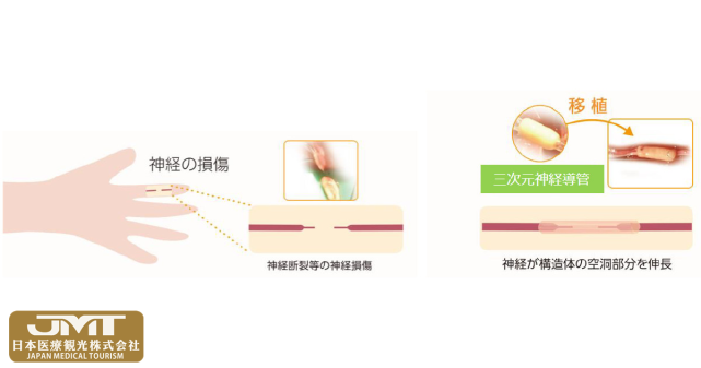 090444dbiousbubbreu9r3.png